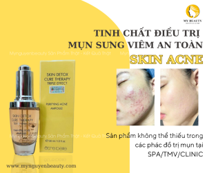 Skin Acne